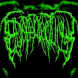 Epicardiectomy